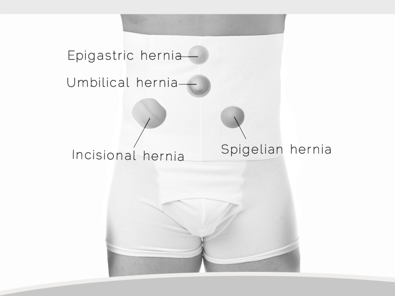 Underworks Men's and Women's Hernia Support 12-inch Tummy Trimming Belt with Velcro closure 348